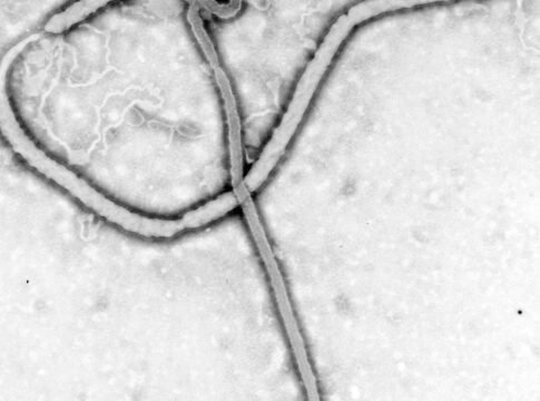 Ebola Vaccine Trial Begins in DRC; Oxford–Serum Candidate Being Prepared