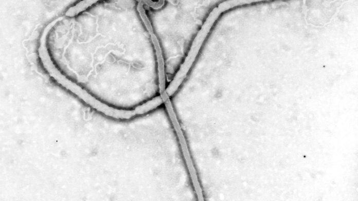 Archival CDC electron micrograph of an Ebola viral particle, not the 2026 Bundibugyo outbreak