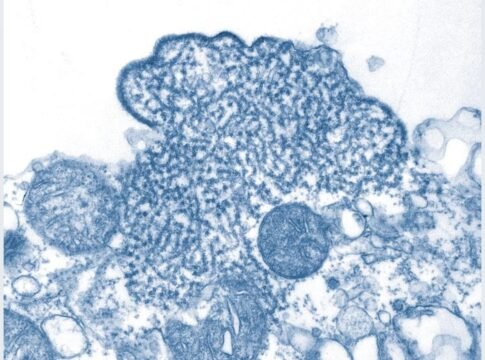 WHO, CEPI and PATH Advance Draft Nipah Severity Score for Future Vaccine Trials