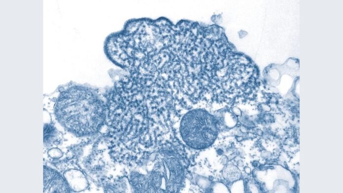 October 31 — Nipah virus particles in a transmission electron micrograph Nipah virus particles in a transmission electron micrograph — archival image, not the current event